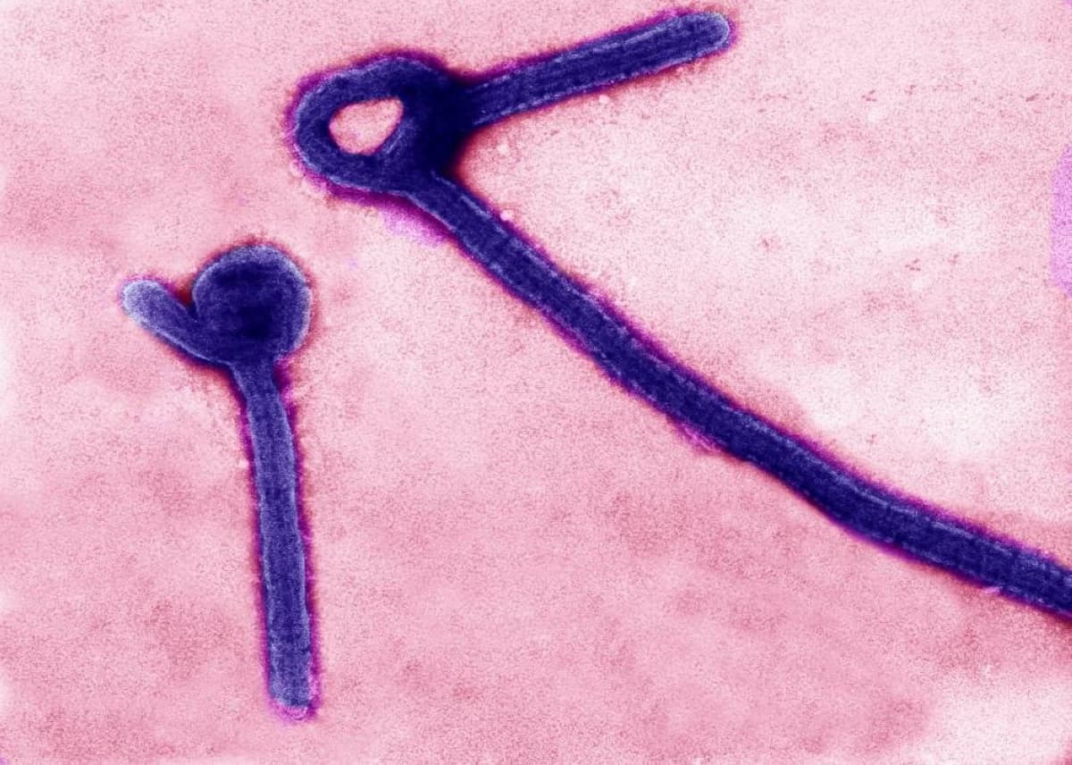 NCEMA, Ministry of Health and Prevention review Ebola virus developments